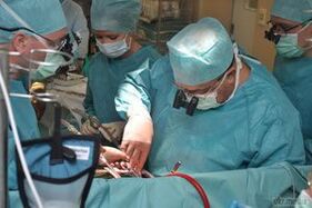 chirurginis dubens venų varikozės gydymas