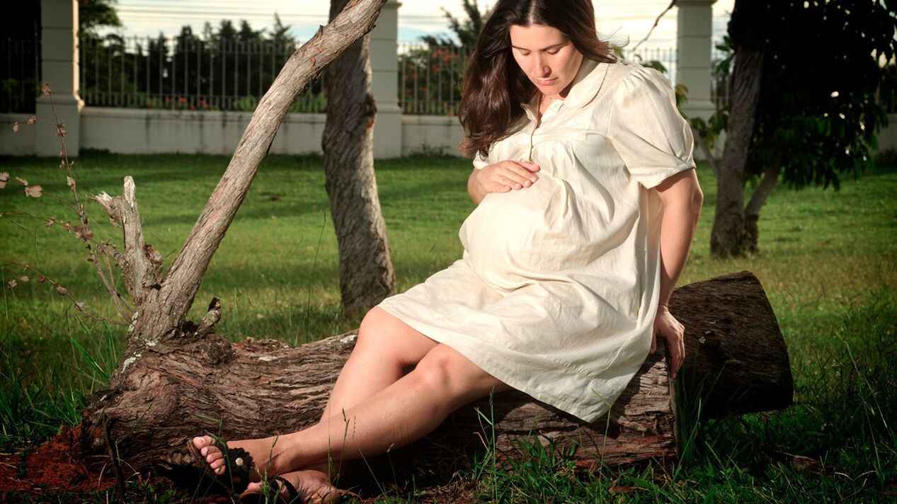 Nėštumas yra kojų venų varikozės vystymosi veiksnys